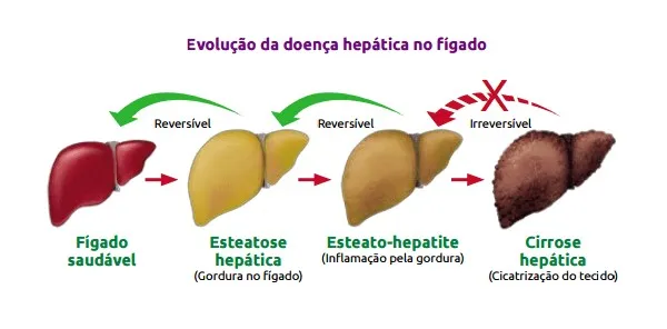 Ilustração