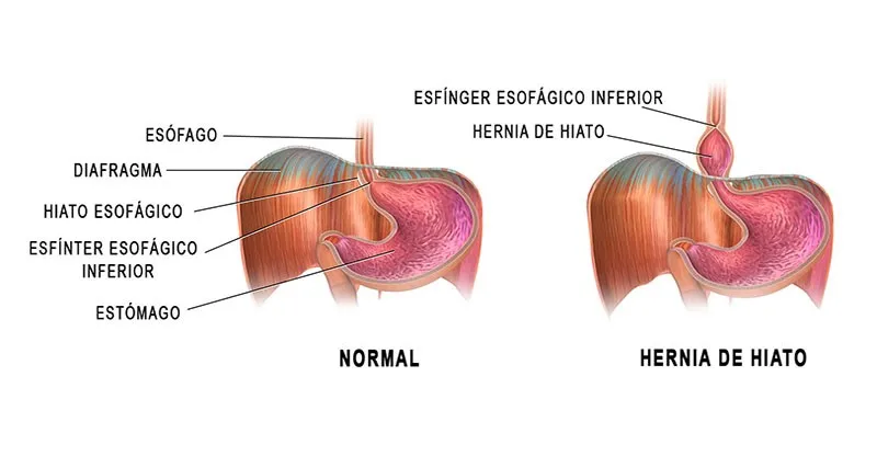 Ilustração