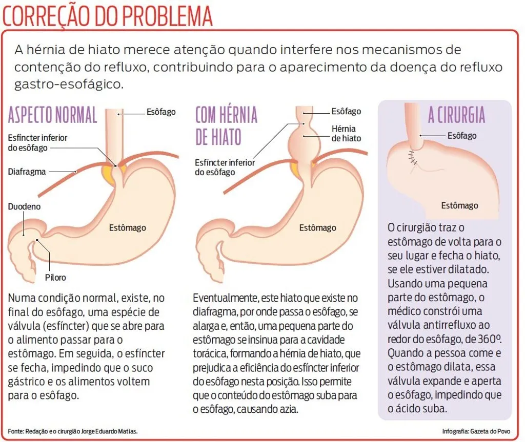 Ilustração